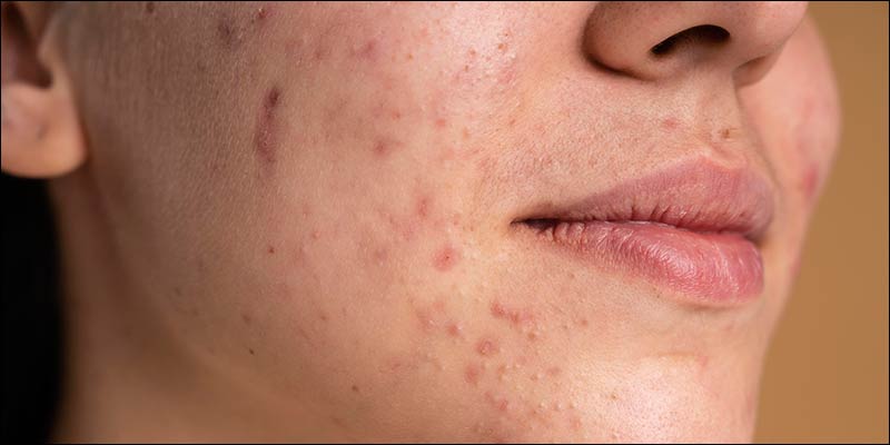 Alomere Health Dermatology