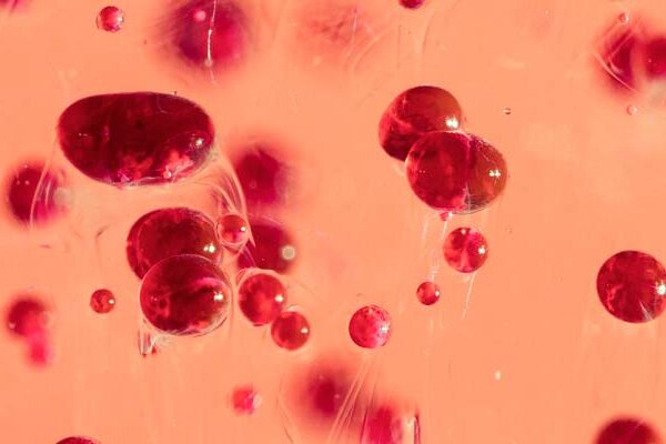 High Red Blood Cell Count